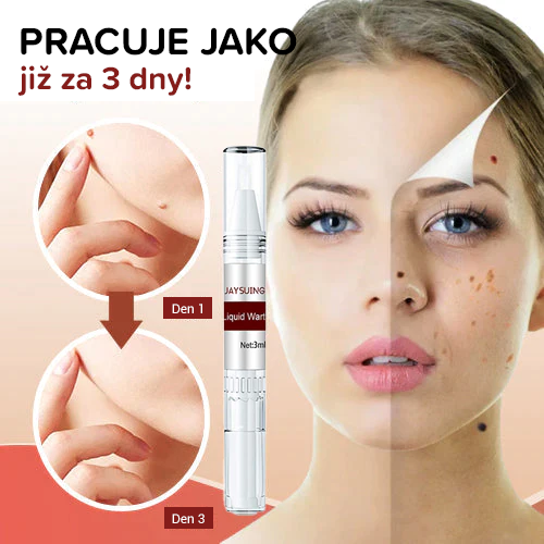 Tekutý krém na bradavice k odstranění kožních bradavic 🛒