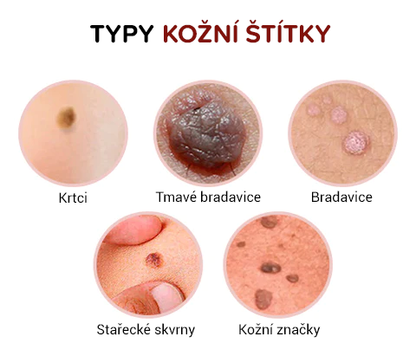 ✨Tekutý krém na bradavice k odstranění kožních bradavic